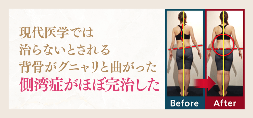 現代医学では治らないとされる	背骨がグニャリと曲がった側湾症がほぼ完治した